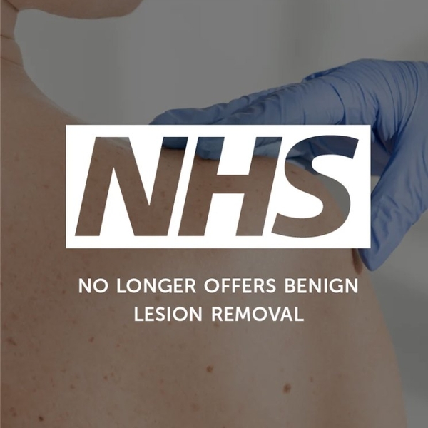 The NHS no longer offers benign lesion removal
